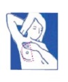 Breast Self Examination 03