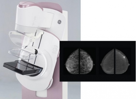 NMC Royal Hospital Sharjah celebrates our first contrast mammography study in the first in the whole Sharjah and Northern Emirates by Dr Mentallah Tawfik, Specialist Breast Radiologist.