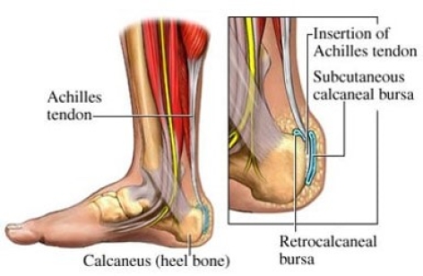 CASES OF THE WEEK – “Additional benefit of bone spect-ct in investigating heel pain (a case of left foot achilles tendonitis)” by Dr ShekharShikare, HOD & Consultant, Nuclear Medicine